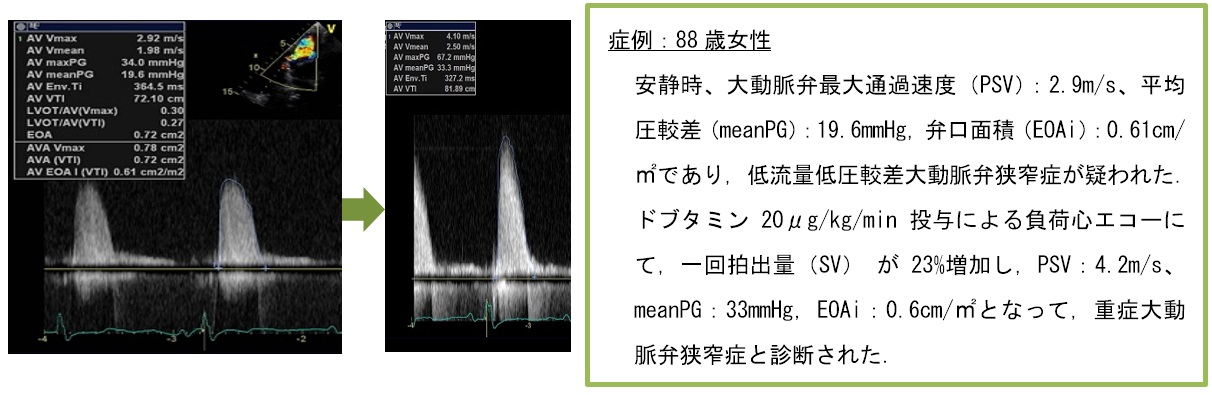 echo2